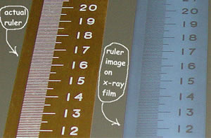 X-ray Scanogram Cetveller 3